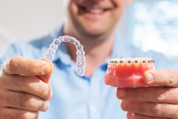 close-up of Damon Braces and Invisalign aligners on a dental model
