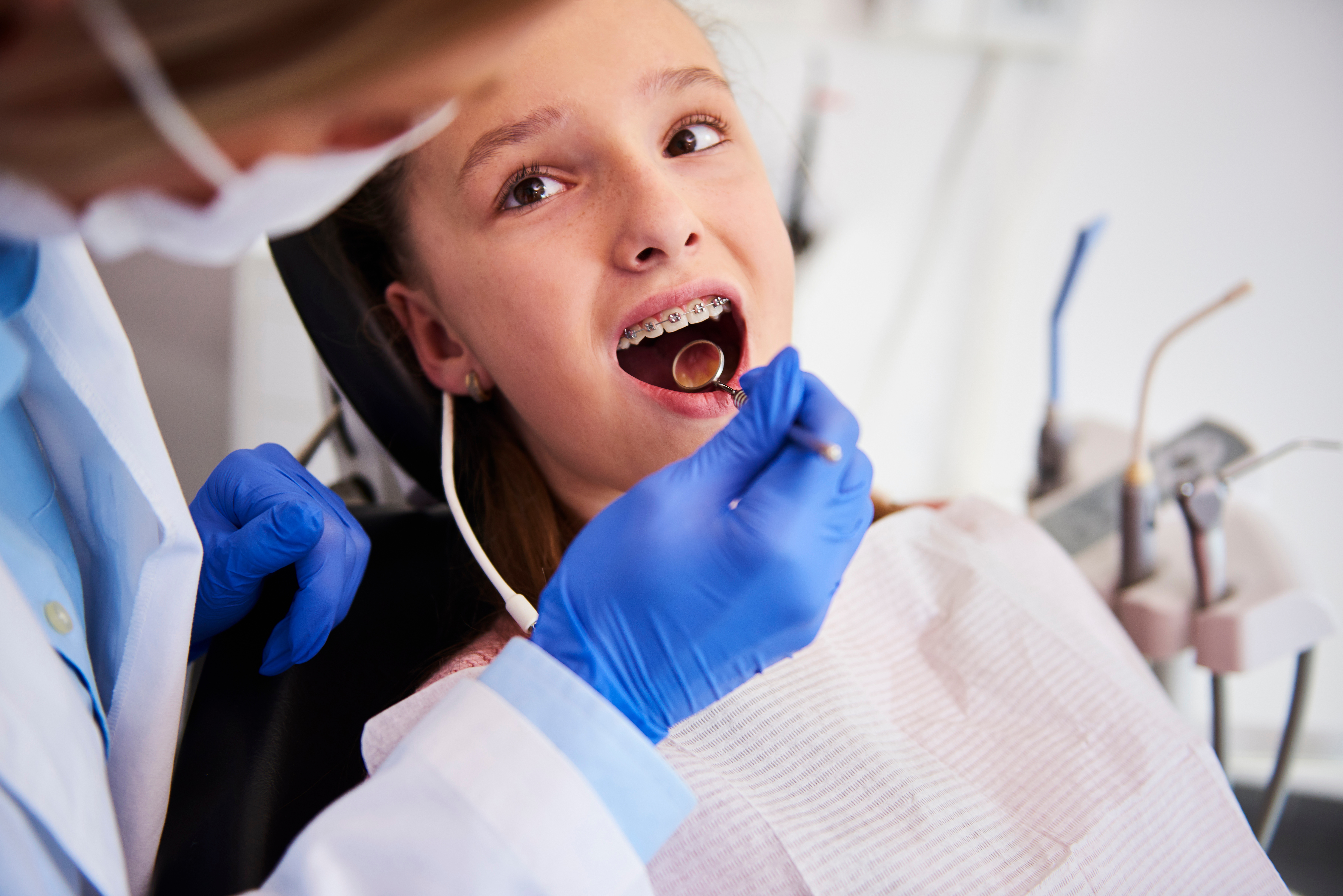 orthodontist placing Damon Braces on a patient