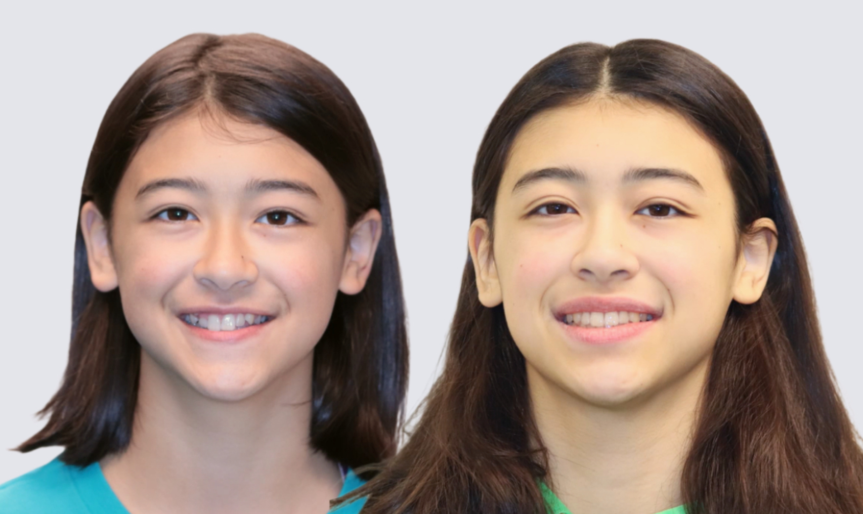 before and after smiling photos side by side