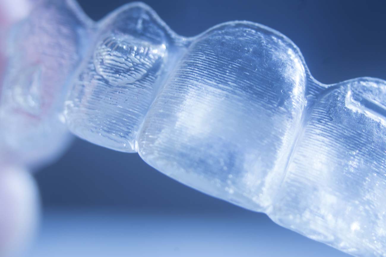 clear aligners used during Portland orthodontic treatment 